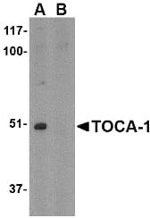 IHC-plus™ Polyclonal Rabbit anti-Human TOCA1 / FNBP1L Antibody (IHC, IF, WB)