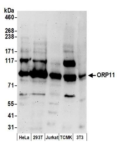OSBPL11 Antibody (aa1-50)