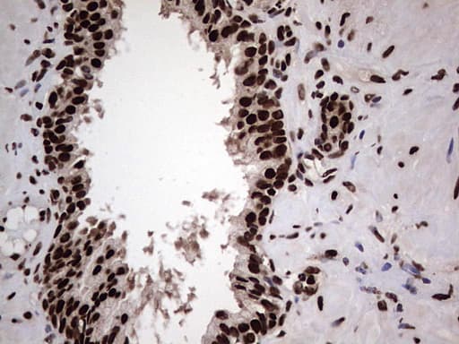 HNRNPL / hnRNP L Antibody (aa270-502, clone OTI9G7, Carrier-free)