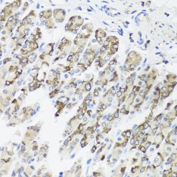 Polyclonal Rabbit anti-Human TIMM10B / FXC1 Antibody (IHC, WB)