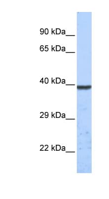 TWIK1 / KCNK1 Antibody (C-Terminus)
