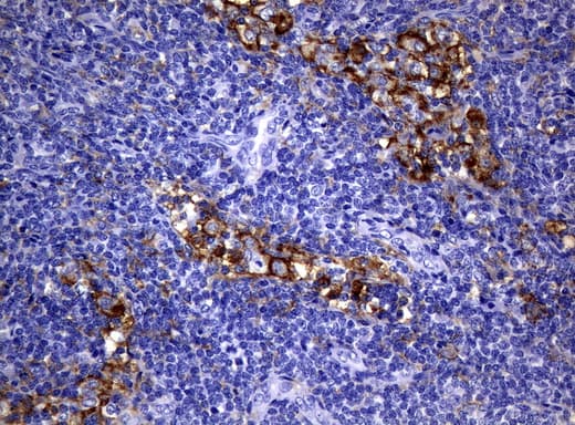 CD32A Antibody (clone UMAB60)