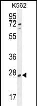 LOC729020 Antibody (aa 187-215, C-term)