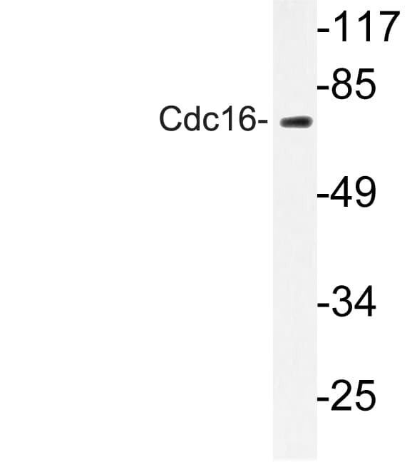 APC6 / CDC16 Antibody (Lys556)