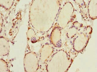 Polyclonal Rabbit anti-Human THRSP Antibody (IHC, WB)