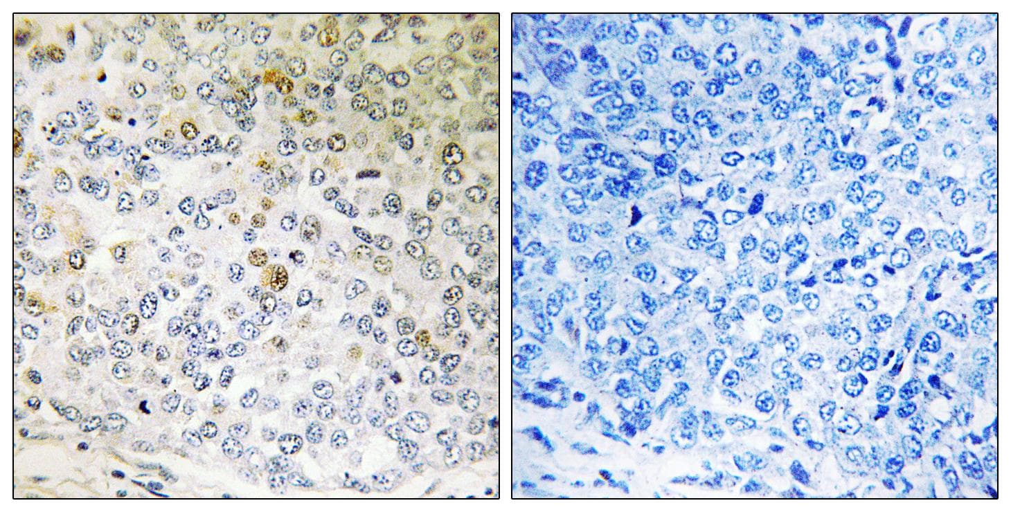 CALML5 Antibody