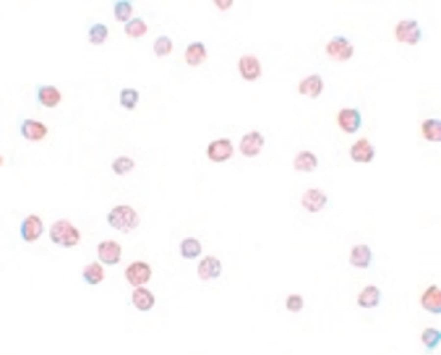 IHC-plus™ Polyclonal Rabbit anti-Human ATP11B Antibody (IHC, IF, WB)