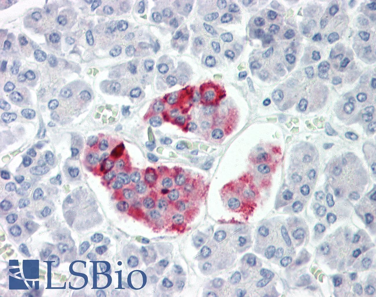 IHC-plus™ Polyclonal Rabbit anti-Human ANKRD20A3 Antibody (aa551-600, IHC)