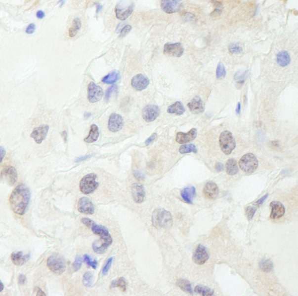 GTF3C1 Antibody (aa1475-1525)