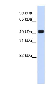 RTCD1 / RPC Antibody (aa36-85)