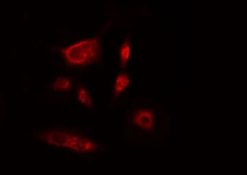 Polyclonal Rabbit anti-Human ITPKB Antibody (IF, WB)