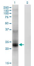CO-029 / TSPAN8 Antibody (clone 1E5)