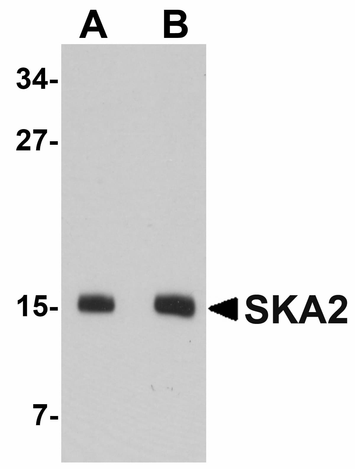 IHC-plus™ SKA2 Antibody