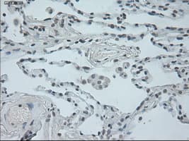 OSM / Oncostatin M Antibody (clone OTI2B6)