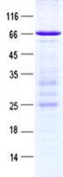 Human NOXO1 Protein (Recombinant GST, N-terminus + His, C-terminus)
