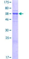 Human SDR42E1 Protein (Recombinant GST)