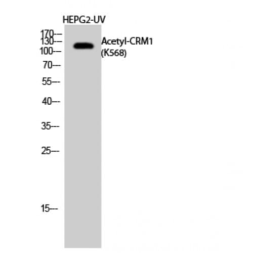 Polyclonal Rabbit anti-Human XPO1 / CRM1 Antibody (Internal, WB)