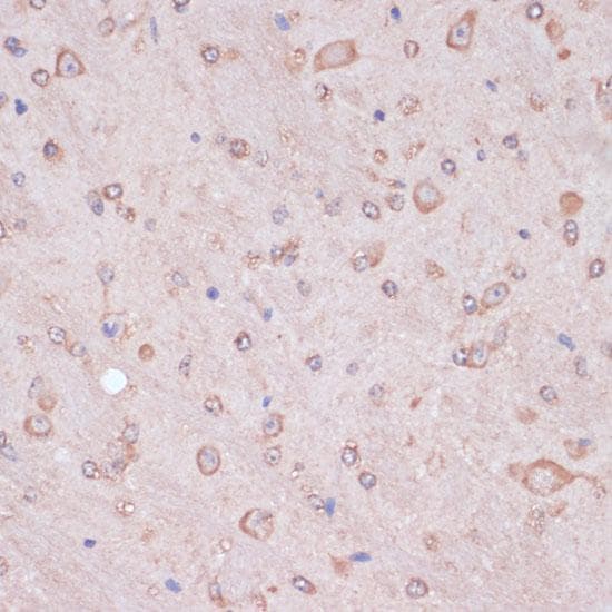 CARTPT / CART Antibody