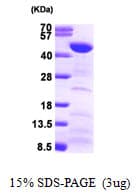 Human FEN1 Protein (Recombinant)