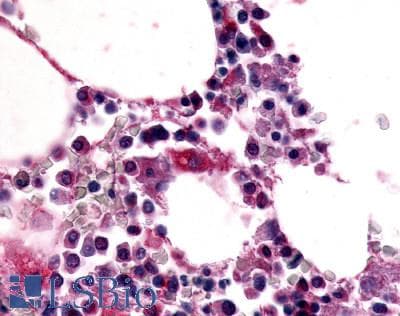 IHC-plus™ ADGRE1 / EMR1 Antibody (N-Terminus)