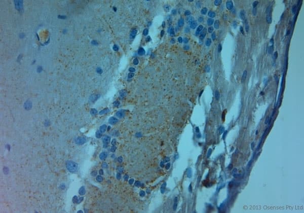 Polyclonal Rabbit anti-Rat GRIN3A / NR3A Antibody (aa1091-1135, IHC)