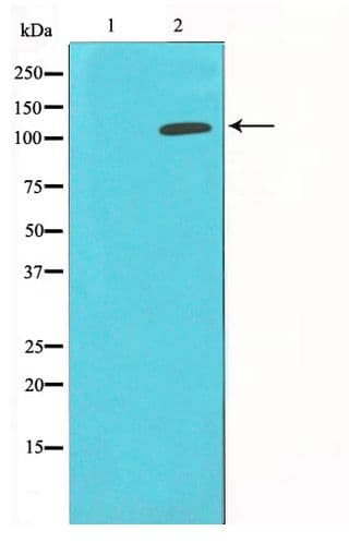 Polyclonal Rabbit anti-Human HDAC9 Antibody (IHC, IF, WB)