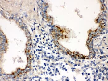 PTP4A2 / PRL-2 Antibody