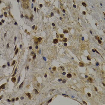 UMPS / OPRT Antibody