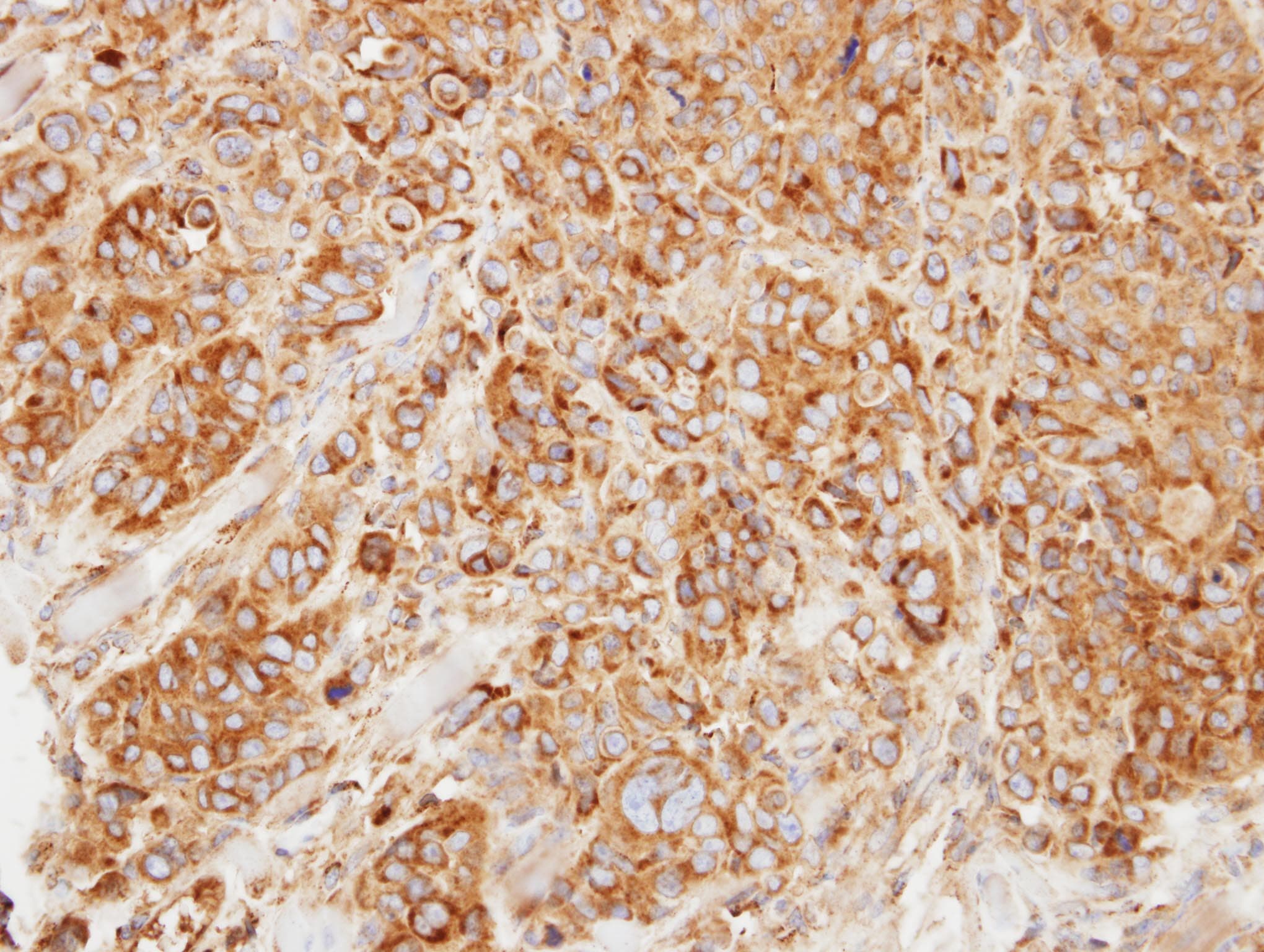 Polyclonal Rabbit anti-Human HMGCL Antibody (aa1-325, IHC, WB)
