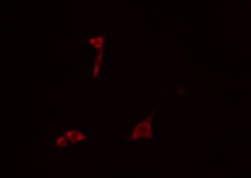 GS28 / GOSR1 / p28 Antibody