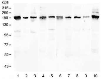 PCDH15 Antibody
