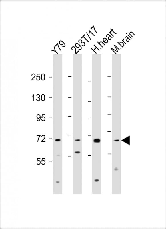ANO10 / TMEM16K Antibody (aa620-653)