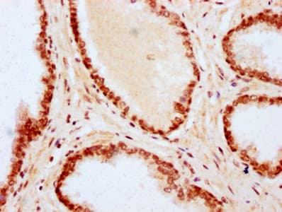 HIST1H2BN Antibody
