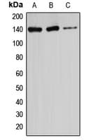 ATXN2 / SCA2 / Ataxin-2 Antibody (Internal)