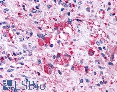 PathPlus™ Polyclonal Rabbit anti-Human GPR146 Antibody (C-Terminus, IHC)