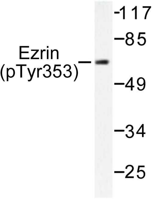 Polyclonal Rabbit anti-Human EZR / Ezrin Antibody (phospho-Tyr353, WB)