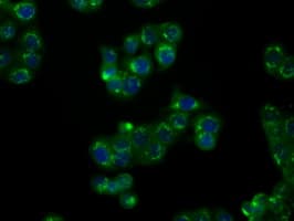 Monoclonal Mouse anti-Human NPR3 Antibody (clone OTI11B6, IHC, IF, WB)