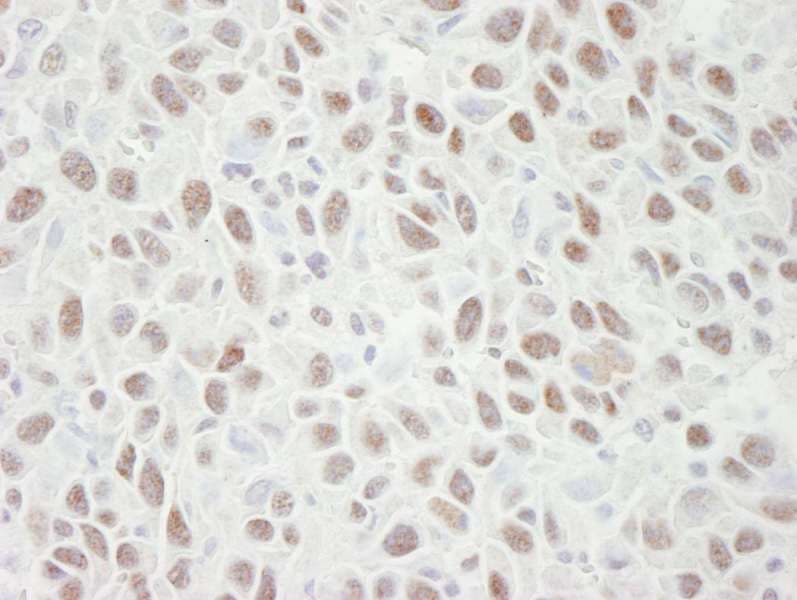 MCM4 Antibody (aa750-800)