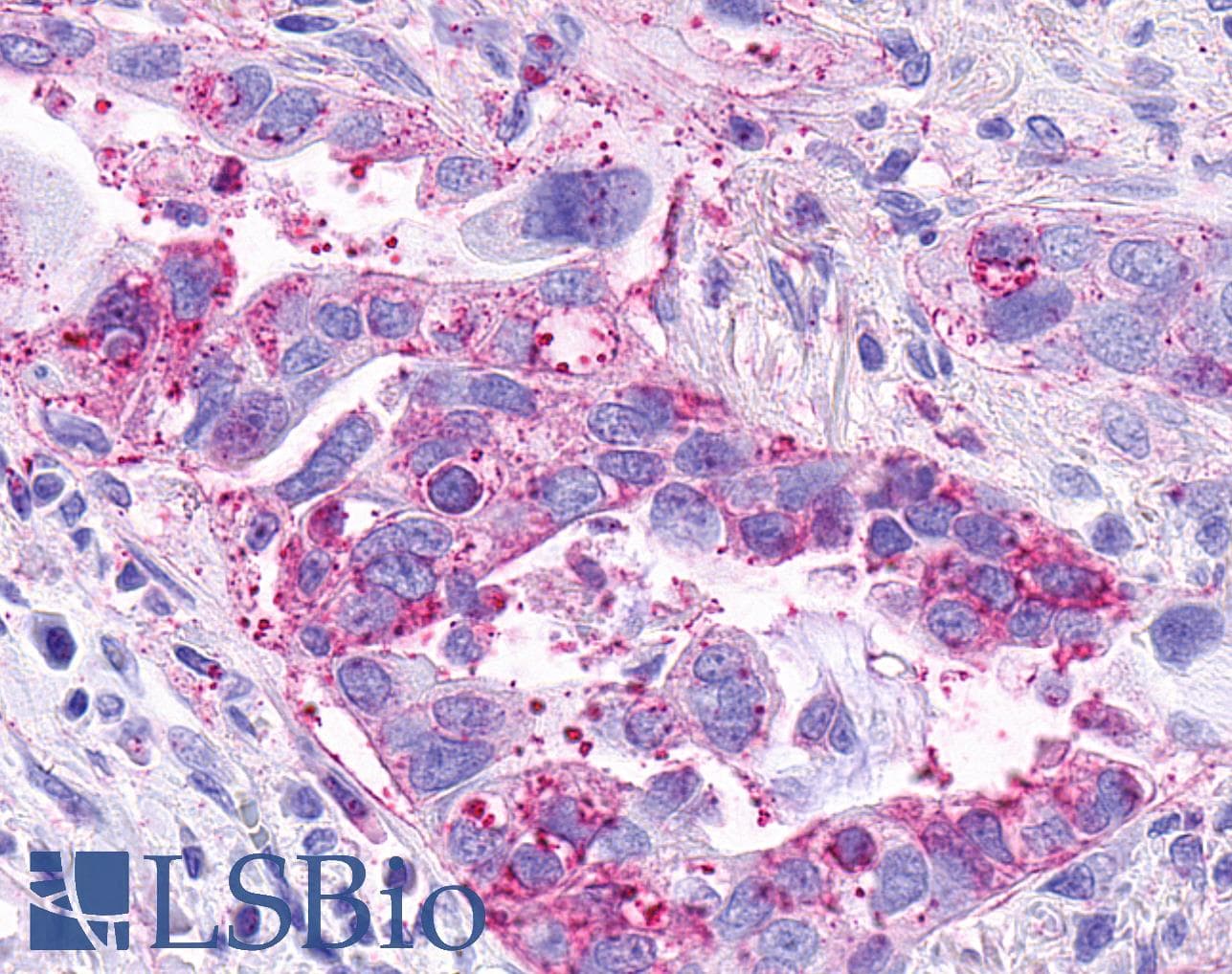 IHC-plus™ CCRL2 Antibody (Cytoplasmic Domain)
