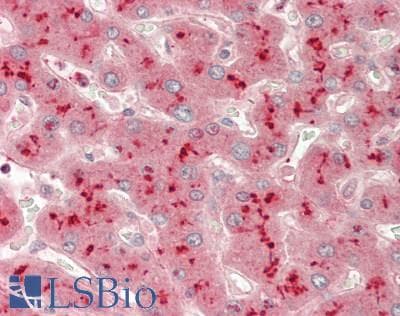 PathPlus™ Polyclonal Rabbit anti-Human ADAM10 Antibody (aa420-641, IHC, WB)