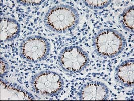 NUDEL / NDEL1 Antibody (clone OTI4E5, Carrier-free)