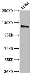 CENPJ / LAP Antibody
