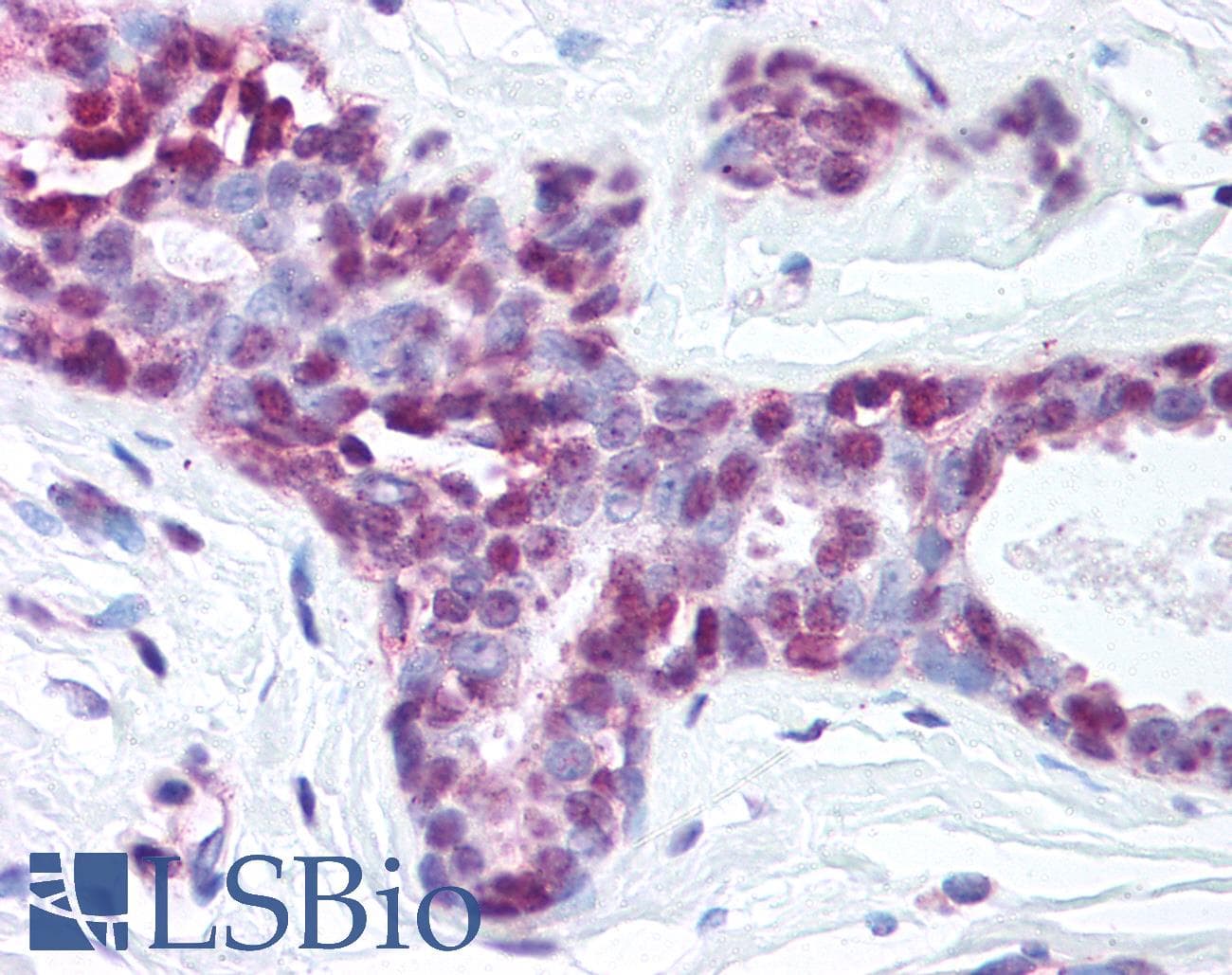 IHC-plus™ NTHL1 Antibody