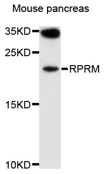 Polyclonal Rabbit anti-Human REPRIMO / RPRM Antibody (WB)