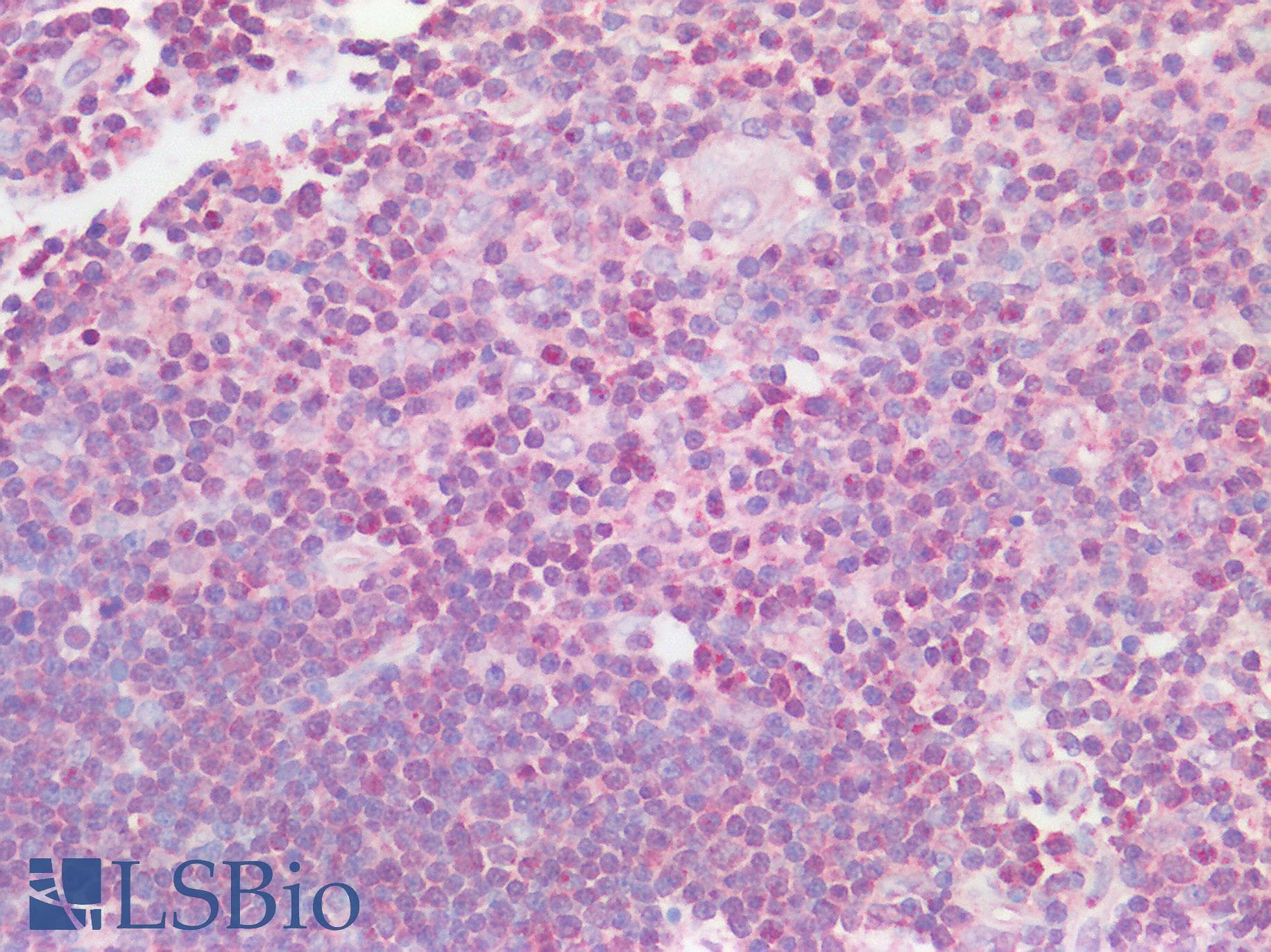 Polyclonal Rabbit anti-Human SRY Antibody (Internal, IHC, WB)