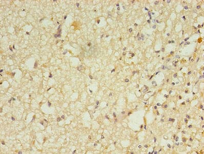 Polyclonal Rabbit anti-Human RGS7 Antibody (IHC)