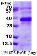 Human RGN / Regucalcin Protein (Recombinant His)