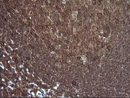 PIK3R5 Antibody (clone OTI5B1)