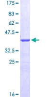 Human CALCRL / CGRP Receptor Protein (Recombinant GST, N-terminus)