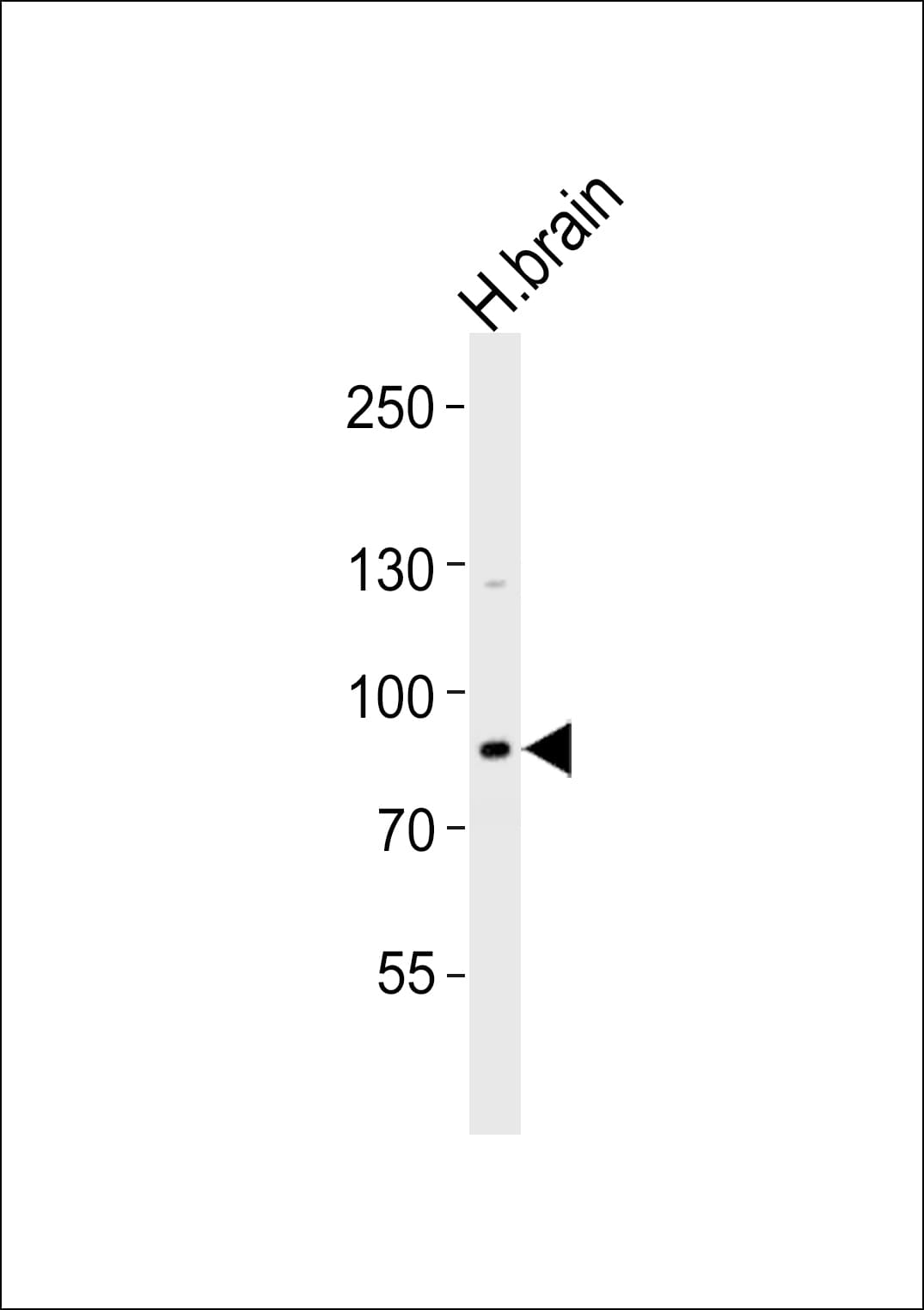 ANKRD20A8P Antibody (Internal)